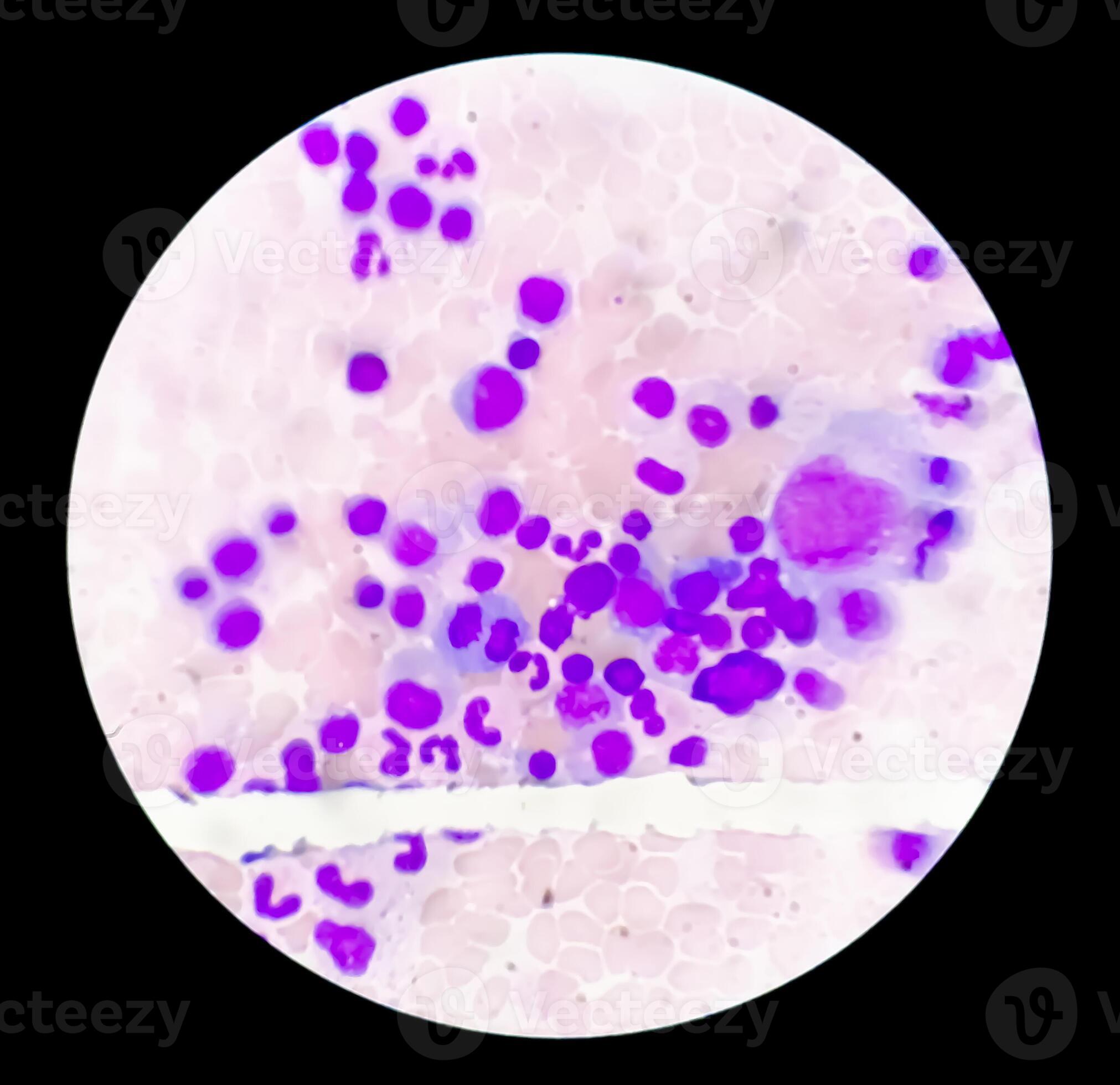 Astonishing Details: A Labeled Photomicrograph Of Bone! - x7lehls