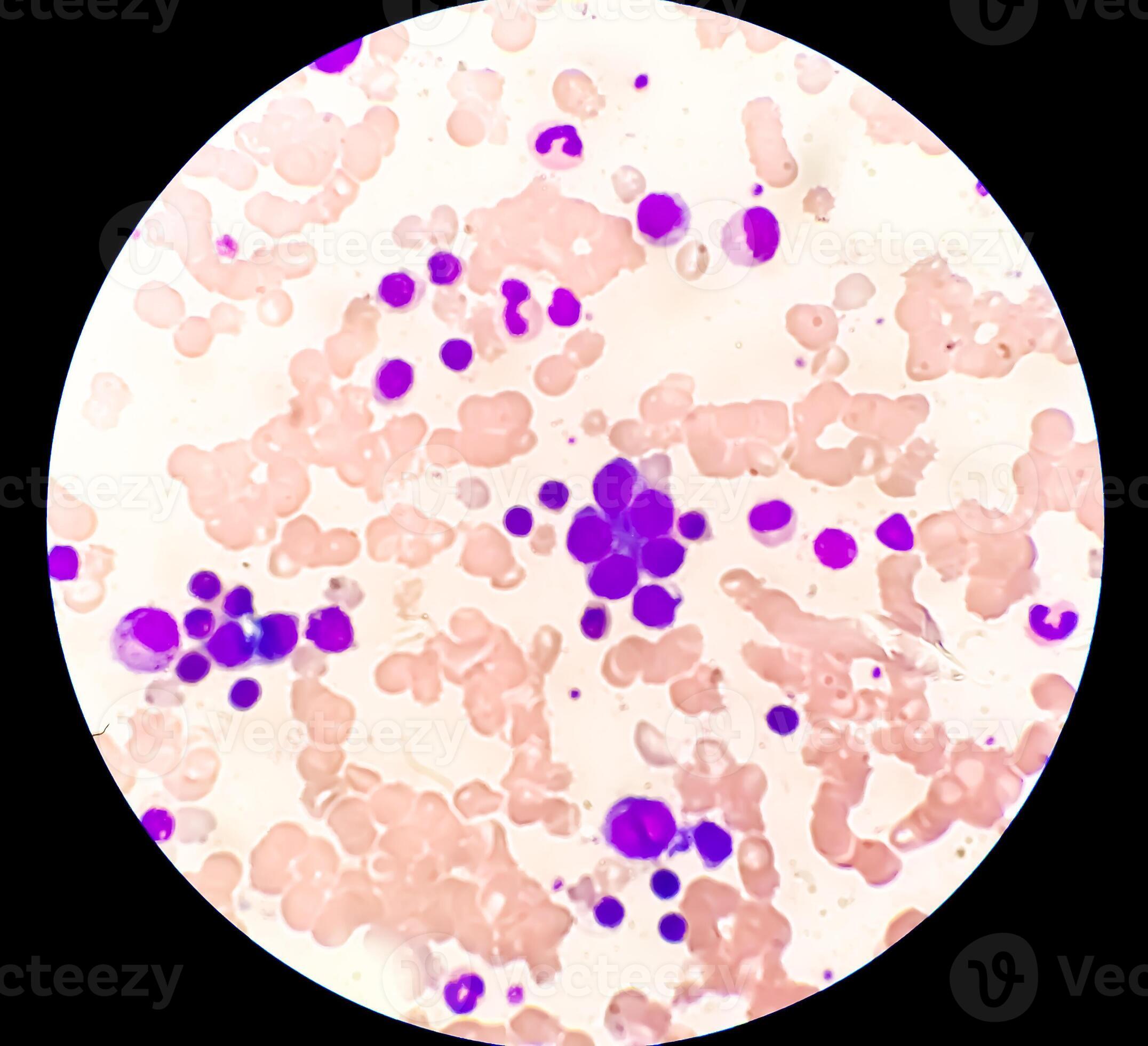 Astonishing Details: A Labeled Photomicrograph Of Bone! - r5hrg5b