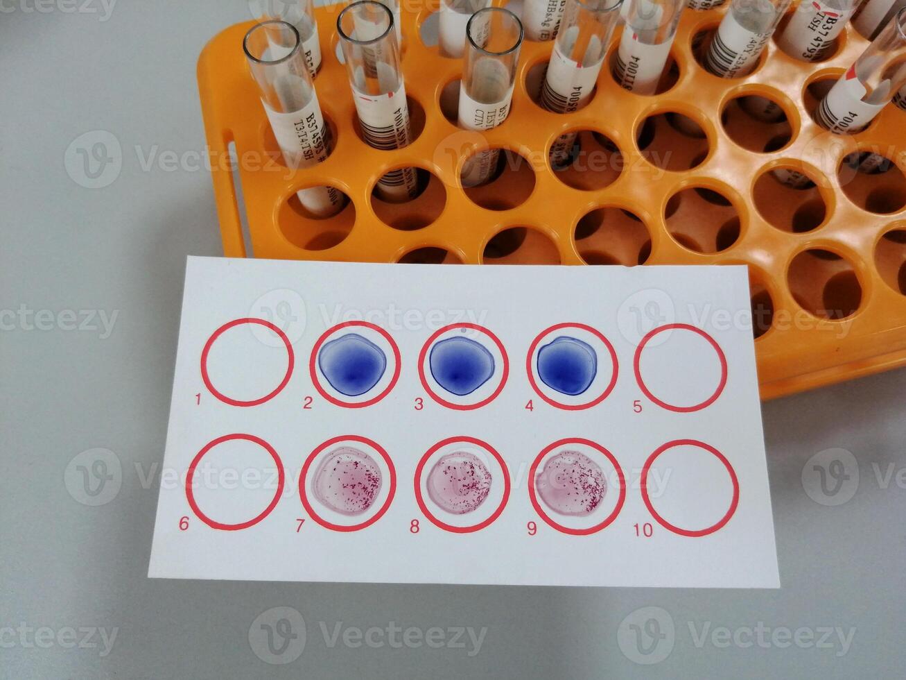 Widal test by agglutination method at plate isolated on black background, to diagnosis Typhoid and Paratyphoid fever at laboratory, Salmonella bacteria disease testing photo