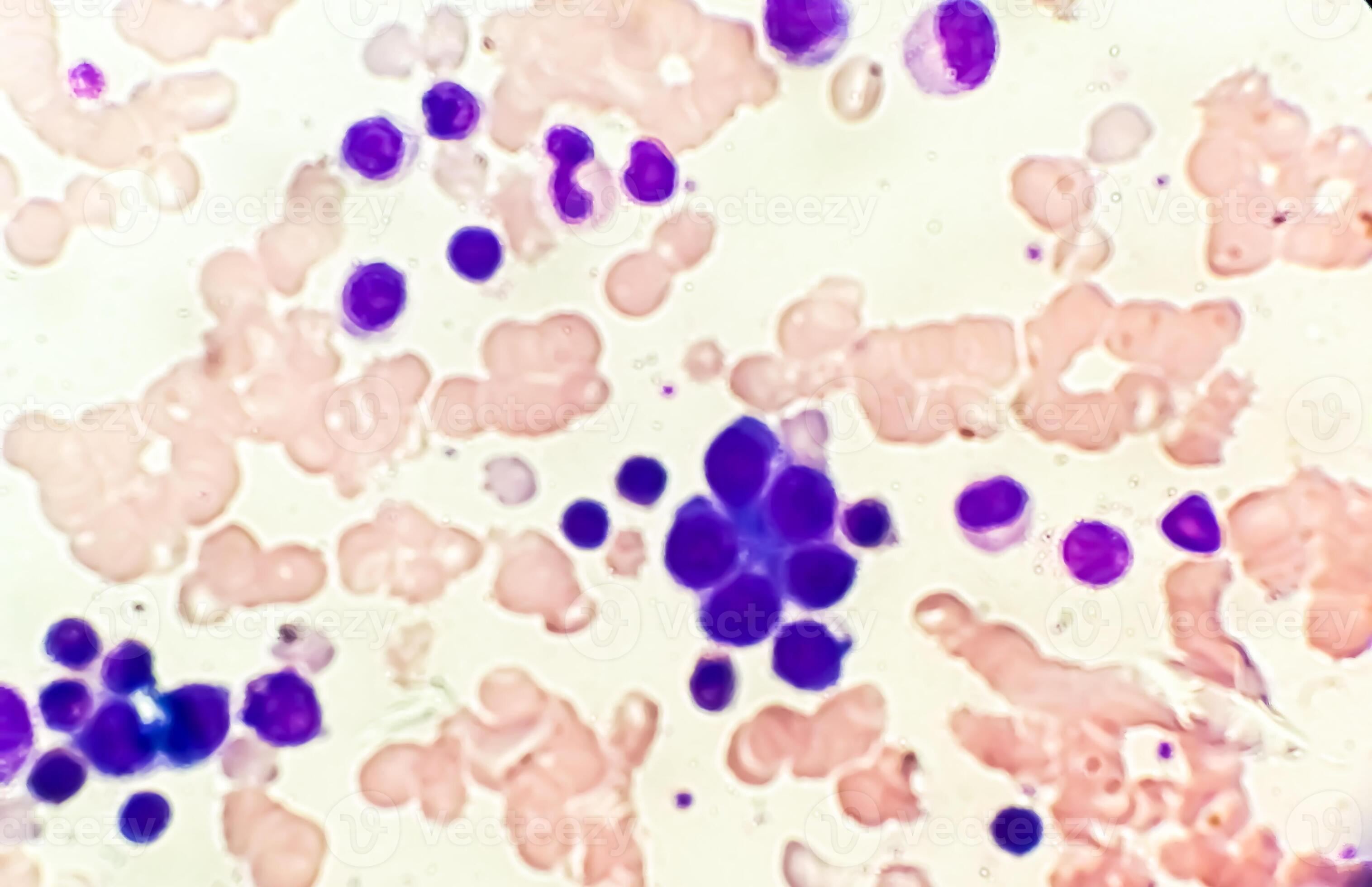 Astonishing Details: A Labeled Photomicrograph Of Bone! - 53w8hnl