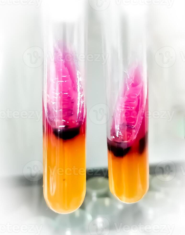 Salmonella detection method by using Triple Sugar Iron or TSI Agar in microbiology laboratory. photo