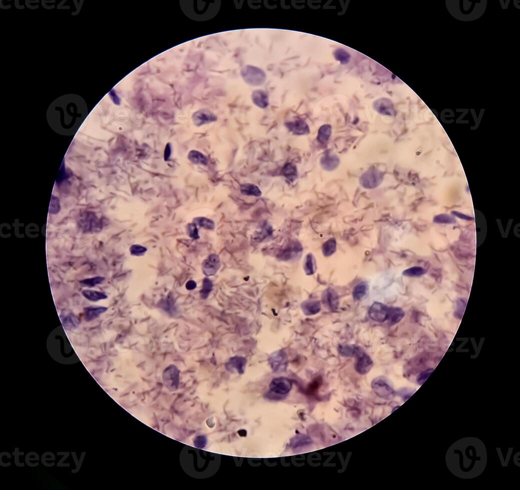 Trichomonas vaginalis is an anaerobic, flagellated protozoan parasite and the causative agent of trichomoniasis. photo