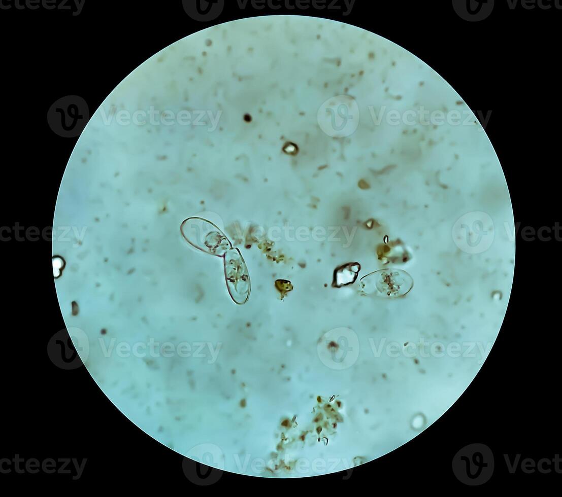 esquistosoma parásito óvulo en humano orina muestra debajo microscopio. urinario parásito foto