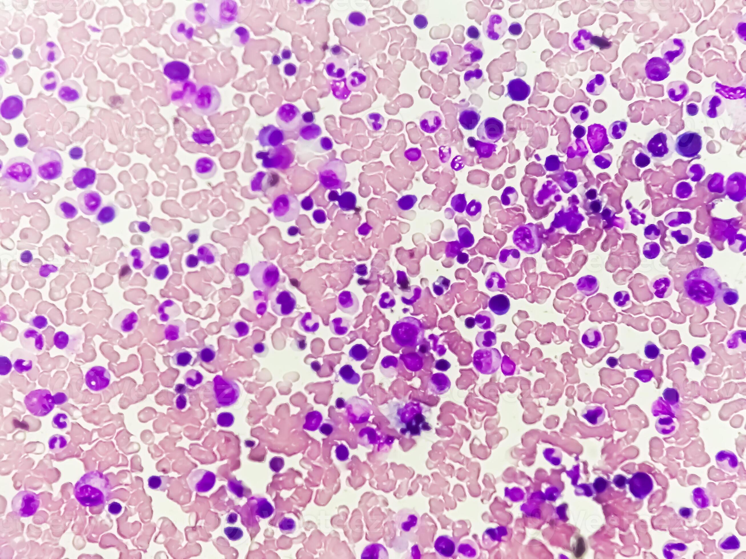 Astonishing Details: A Labeled Photomicrograph Of Bone! - ryn6re6