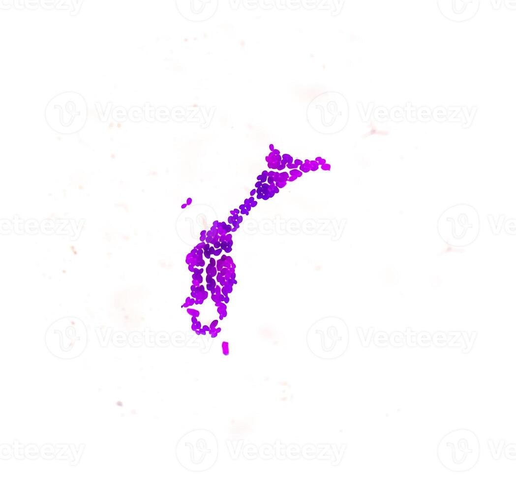 Pus gram stained microscopic showing gram positive bacteria. photo