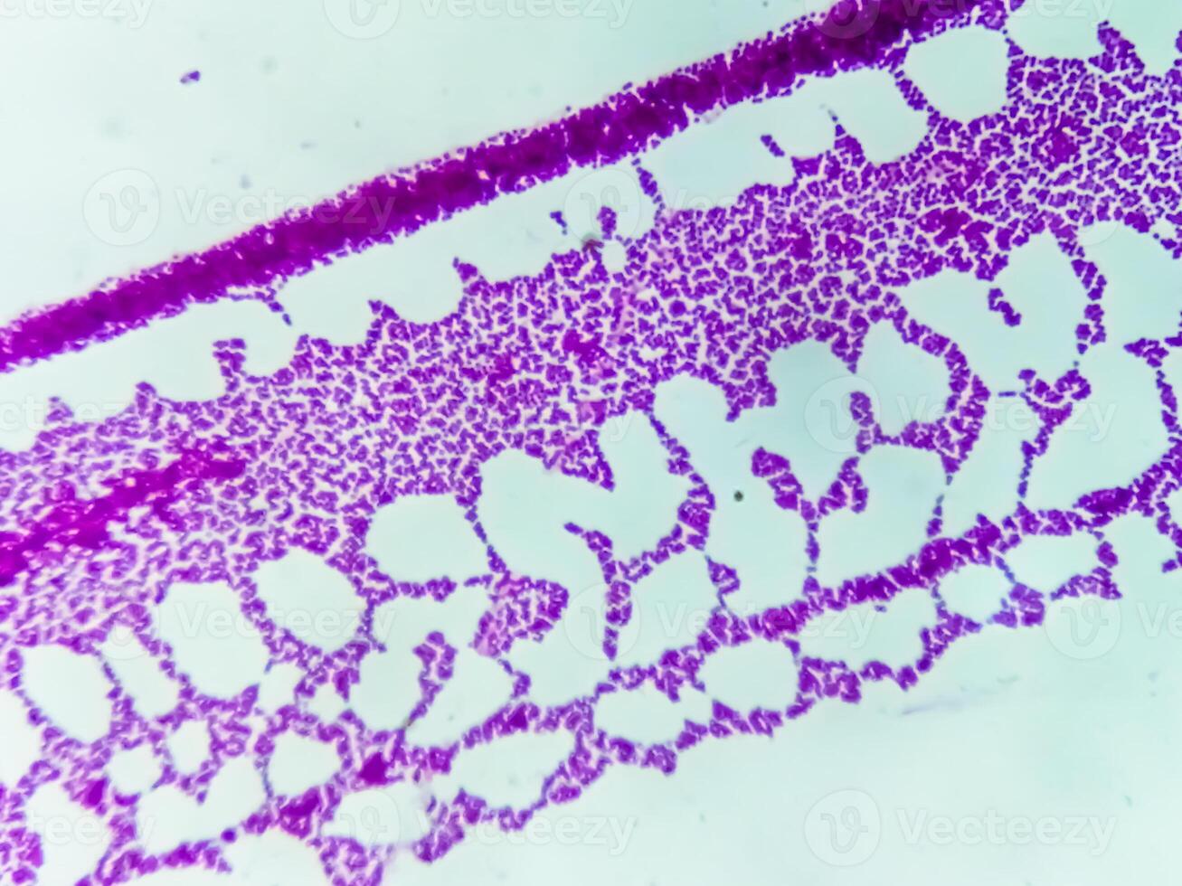 Pus gram stained microscopic showing gram positive bacteria. photo