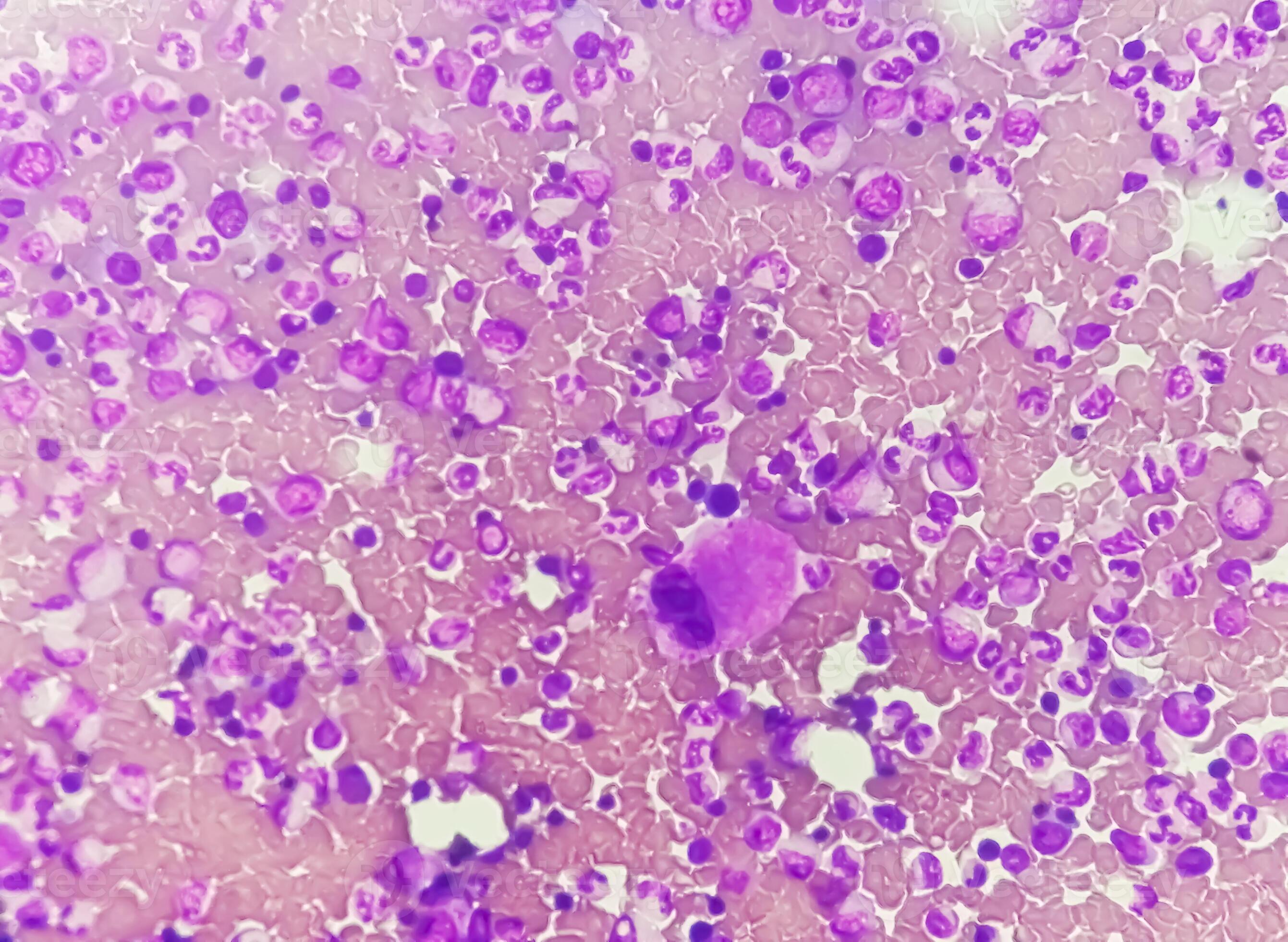 Astonishing Details: A Labeled Photomicrograph Of Bone! - nfissku