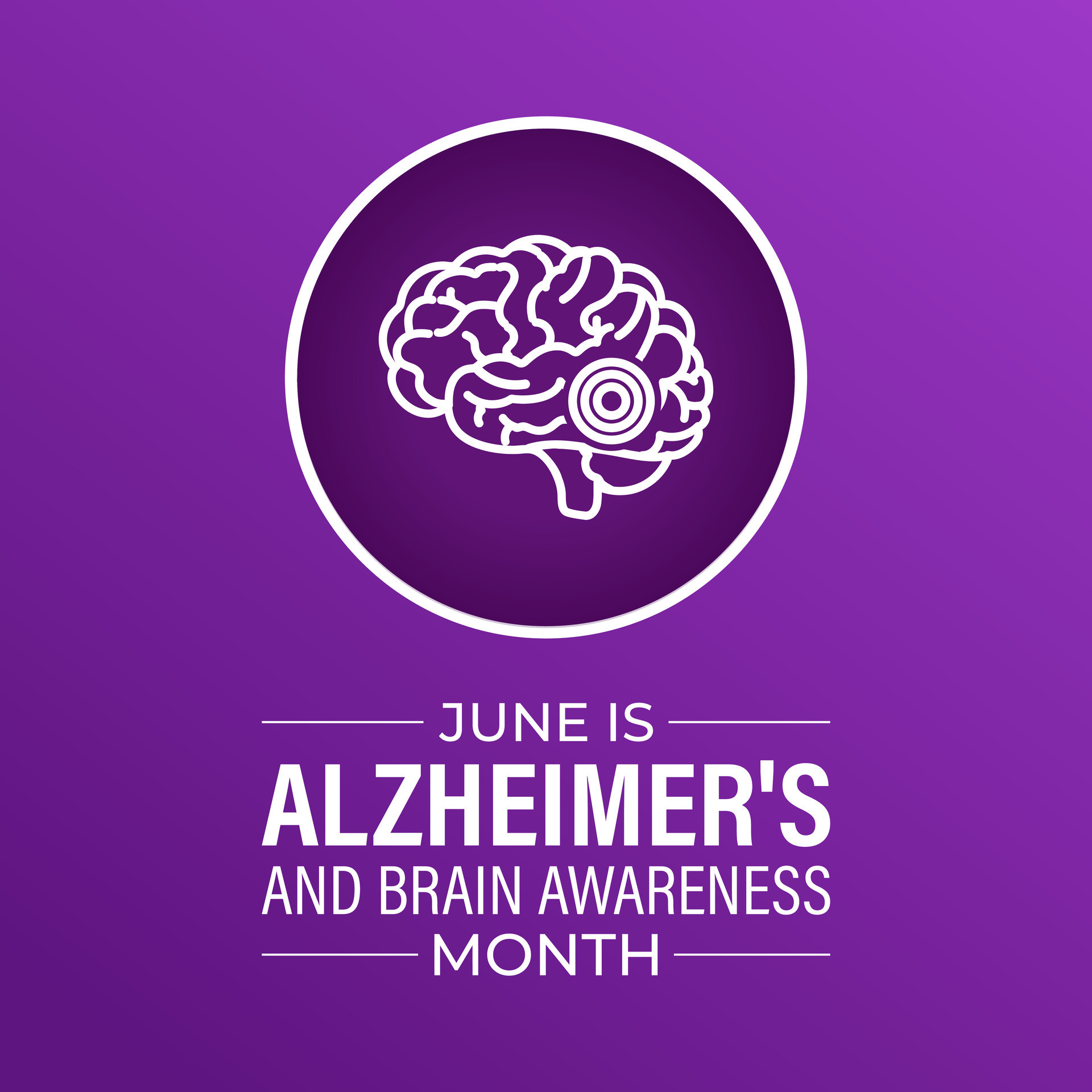 Alzheimer