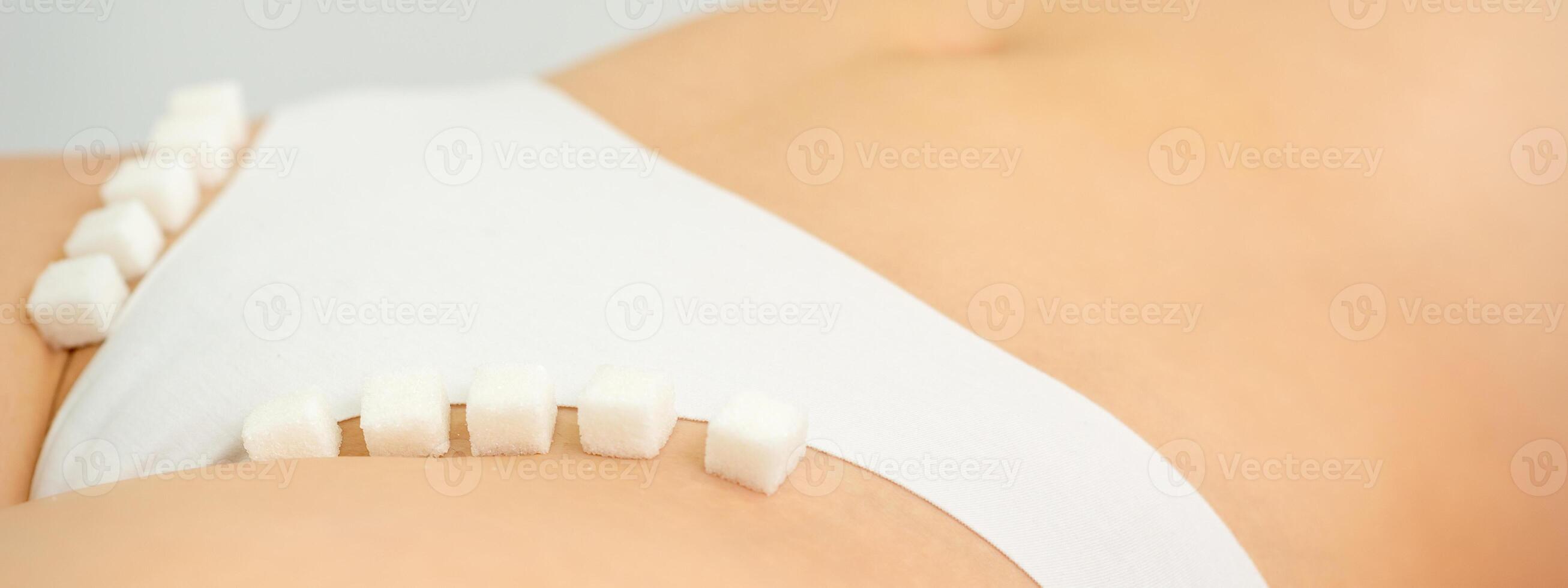 Sugar cubes lying in a row on female bikini zone, the concept of intimate depilation, problems of intimate hygiene. photo