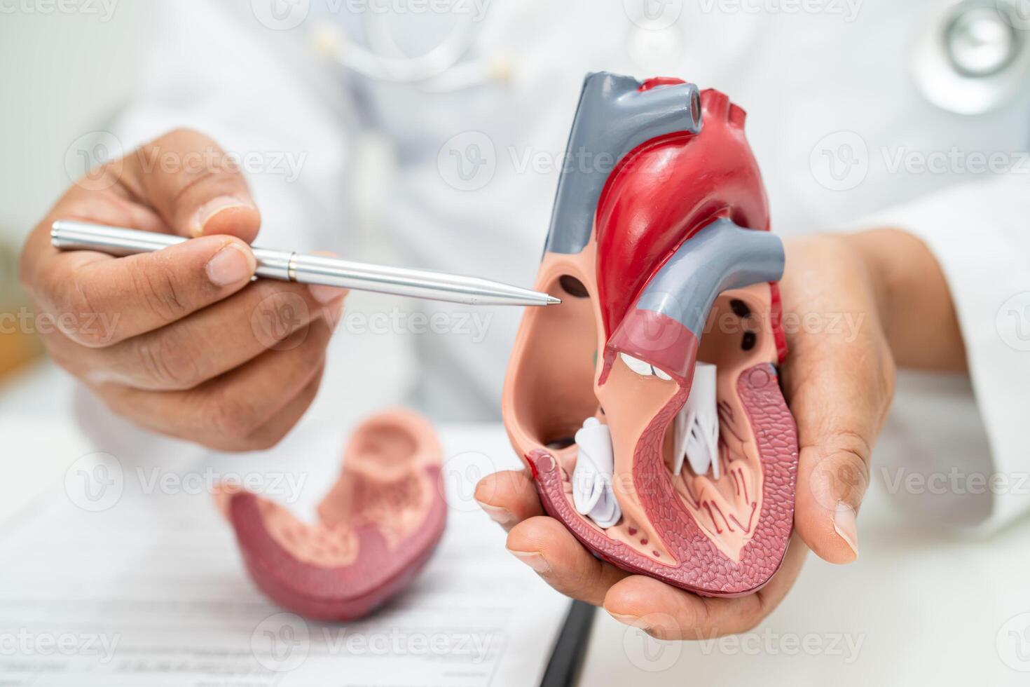 Cardiovascular disease CVD, Asian doctor holding human anatomy model for learn and treat heart disease. photo