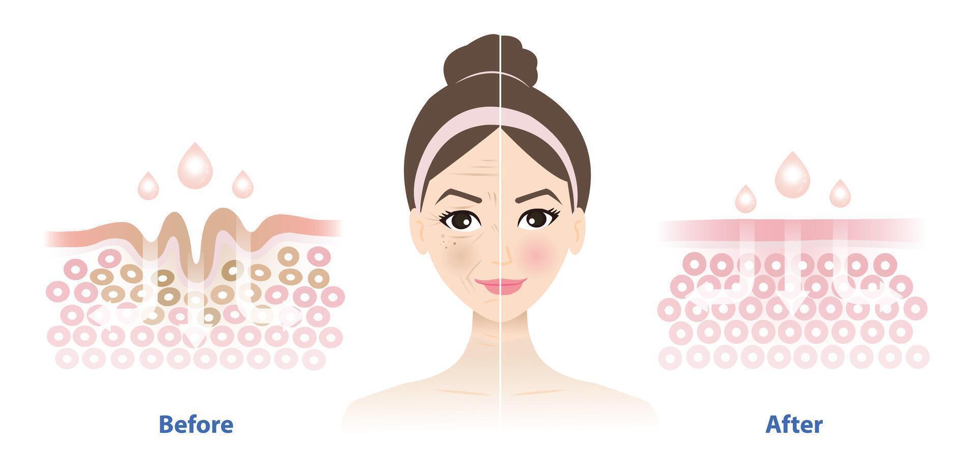 Comparison of woman face before and after skincare reduce wrinkles. Cross section of wrinkles skin and skincare absorbing to help reduce aging and damaged skin. Skin care and beauty concept. vector
