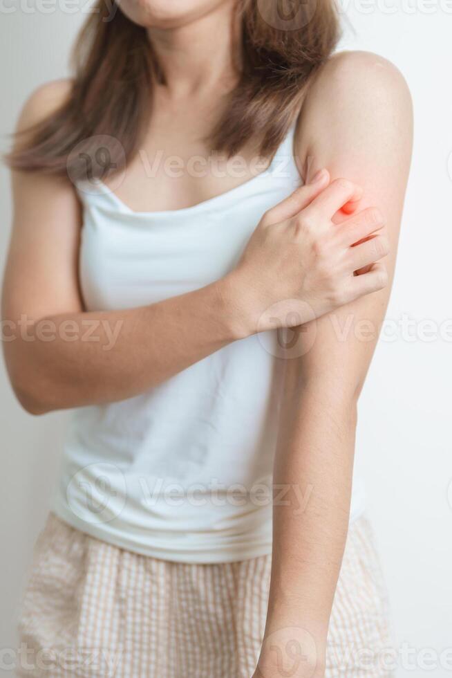 woman itching and scratching itchy arm. Sensitive Skin Allergic reaction to insect bite, food, drug dermatitis. Dermatology, Leprosy day, Systemic lupus erythematosus, Allergy symptoms and rash Eczema photo