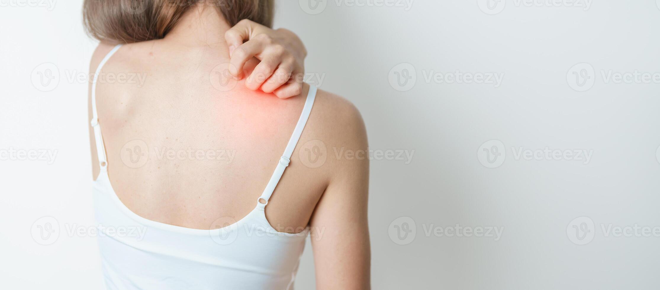 woman itching and scratching itchy back. Sensitive Skin Allergic reaction to insect bite, food, drug dermatitis. Dermatology, Leprosy, Systemic lupus erythematosus, Allergy symptoms and rash Eczema photo