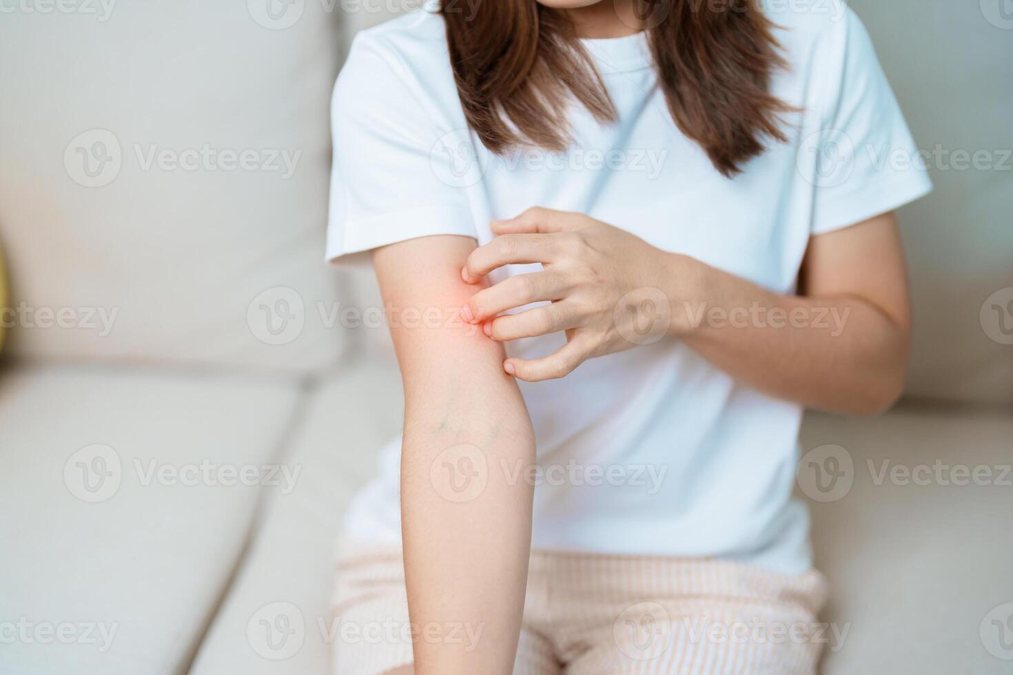 woman itching and scratching itchy arm. Sensitive Skin Allergic reaction to insect bite, food, drug dermatitis. Dermatology, Leprosy day, Systemic lupus erythematosus, Allergy symptoms and rash Eczema photo