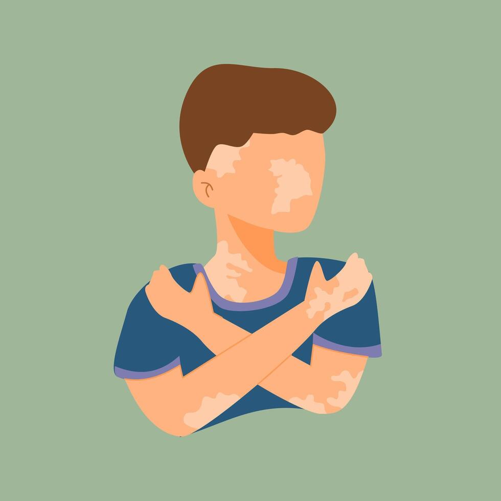 Portrait of a Young Boy with Unique Skin Wearing a Blue Shirt in Front of a Green Background vector