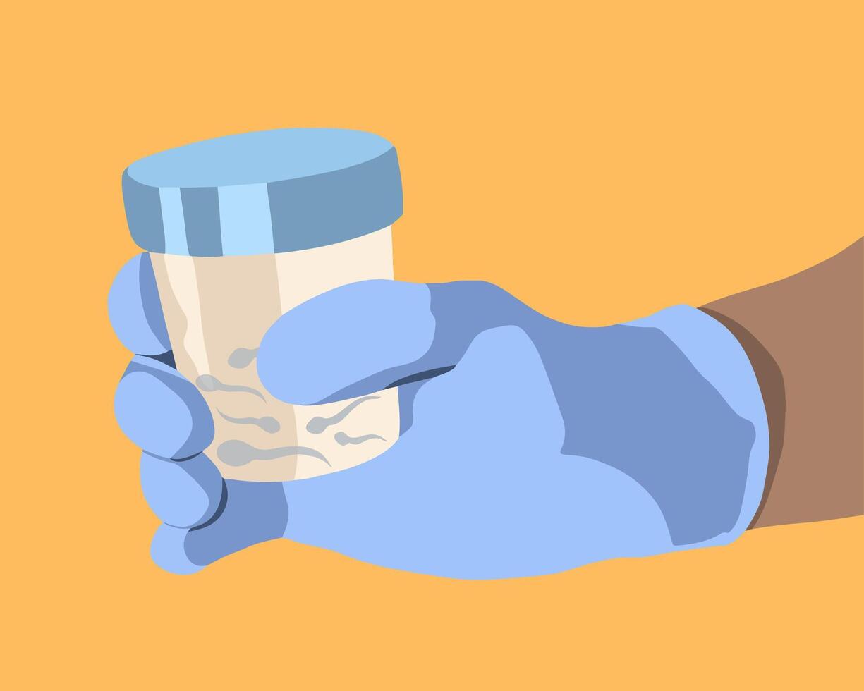 Illustration of container with sperm in human hand. Sperm donor. vector