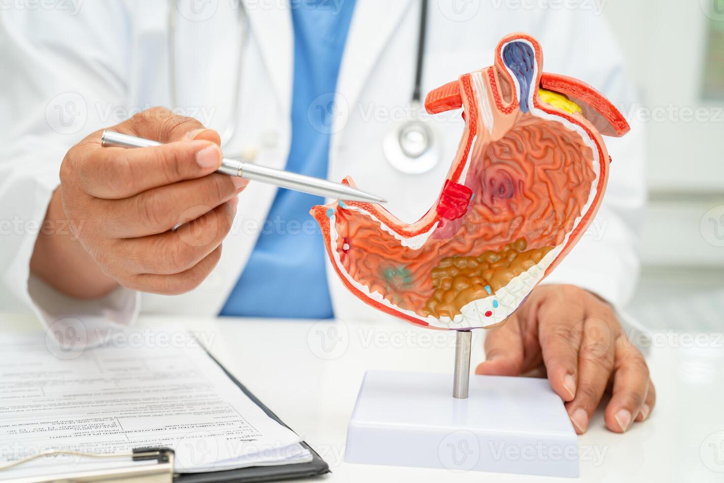 Stomach disease, doctor with anatomy model for study diagnosis and treatment in hospital. photo