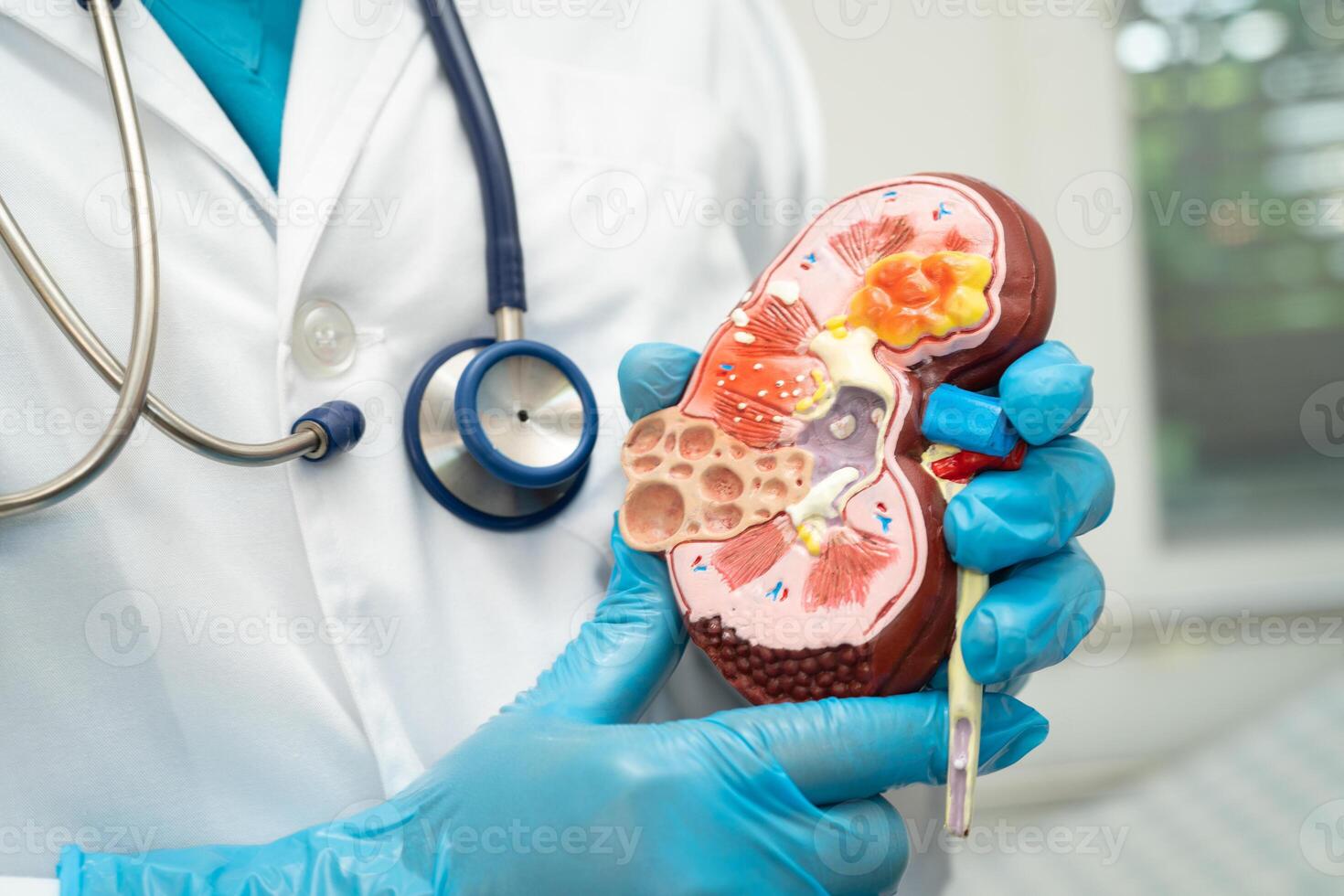 Kidney disease, Chronic kidney disease ckd, Doctor with human model to study and treat in hospital. photo