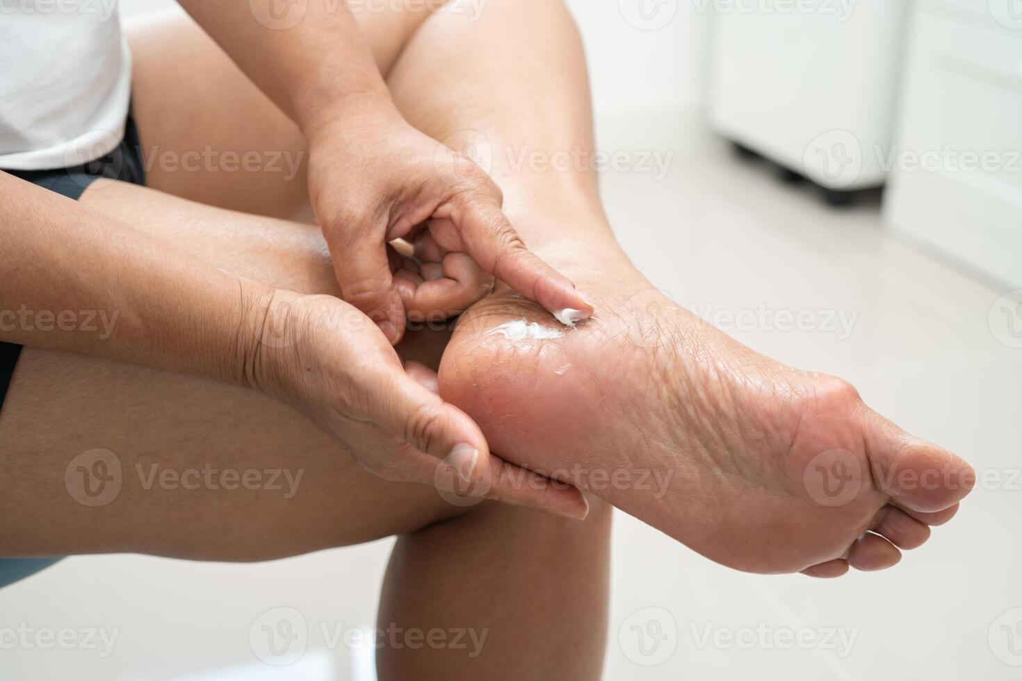 Asian woman care feet with cracked and dry heel skin cream at home. photo