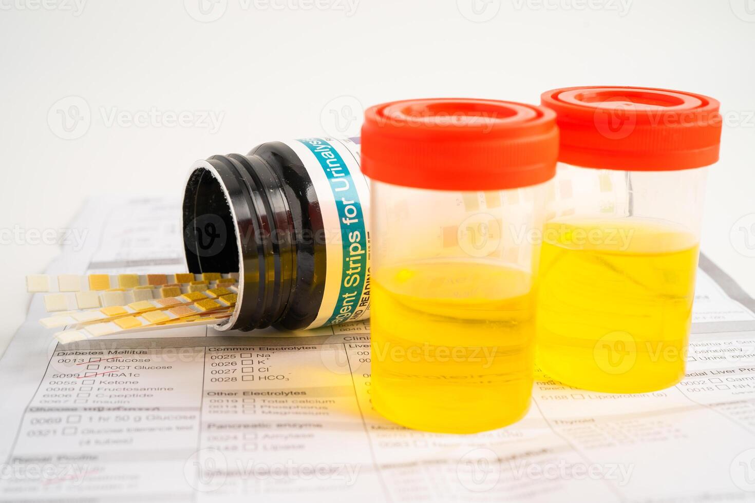 Urinalysis, urine cup with reagent strip pH paper test and comparison chart in laboratory. photo