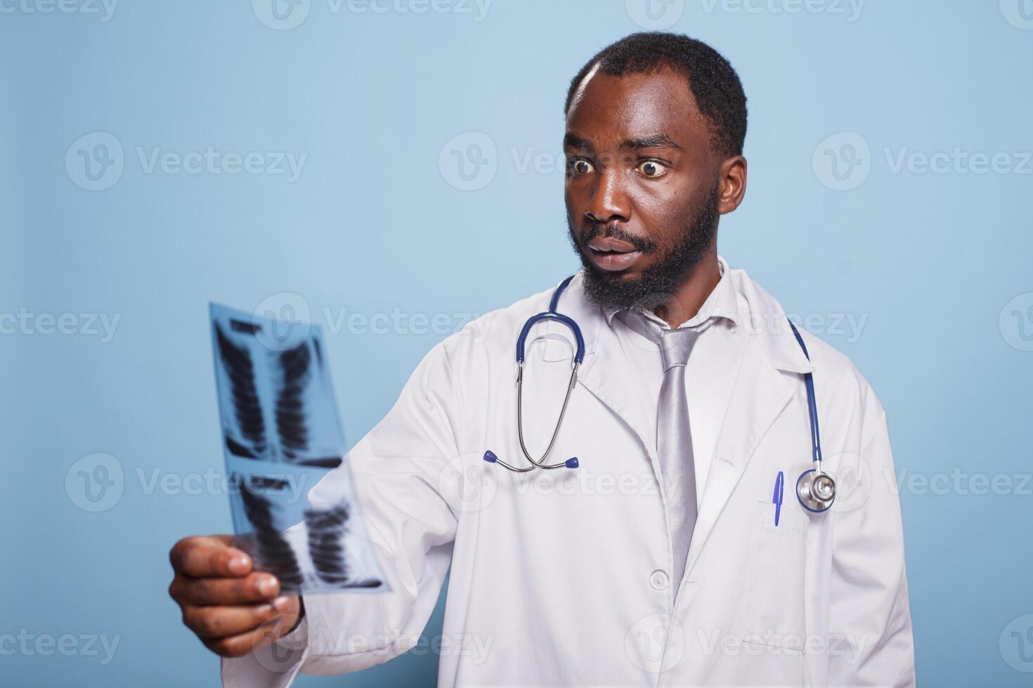 Shocked doctor wearing white lab coat and stethoscope staring at a chest x-ray image that shows alarming test results. Medical professional holding a diagnosis of pulmonary radiography. photo