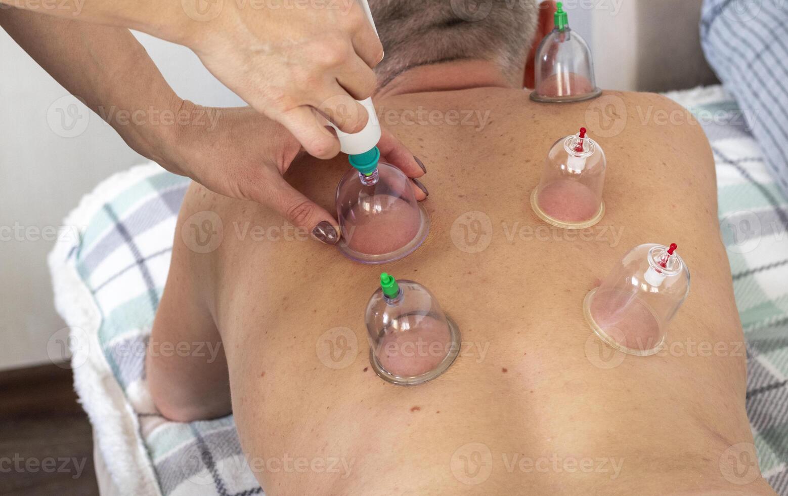 Shot of the female doctor in uniform against the white wall examining mid age male patient, performing cupping therapy. Healthcare photo