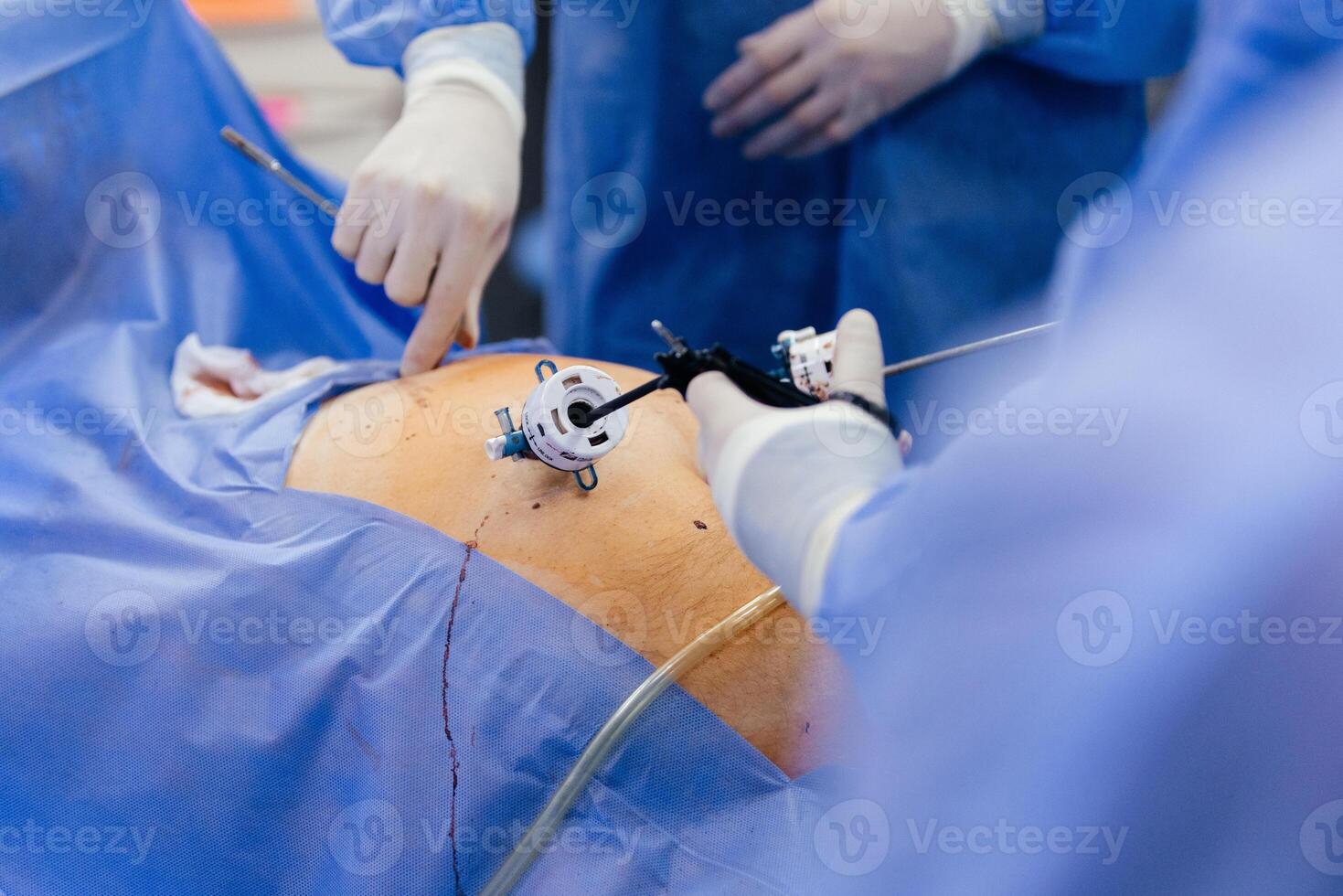 Instruments for gastroscopy and colonoscopy close-up. The doctor holds a flexible endoscope and biopsy forceps in his hands. Endoscopy and minimally invasive surgery photo