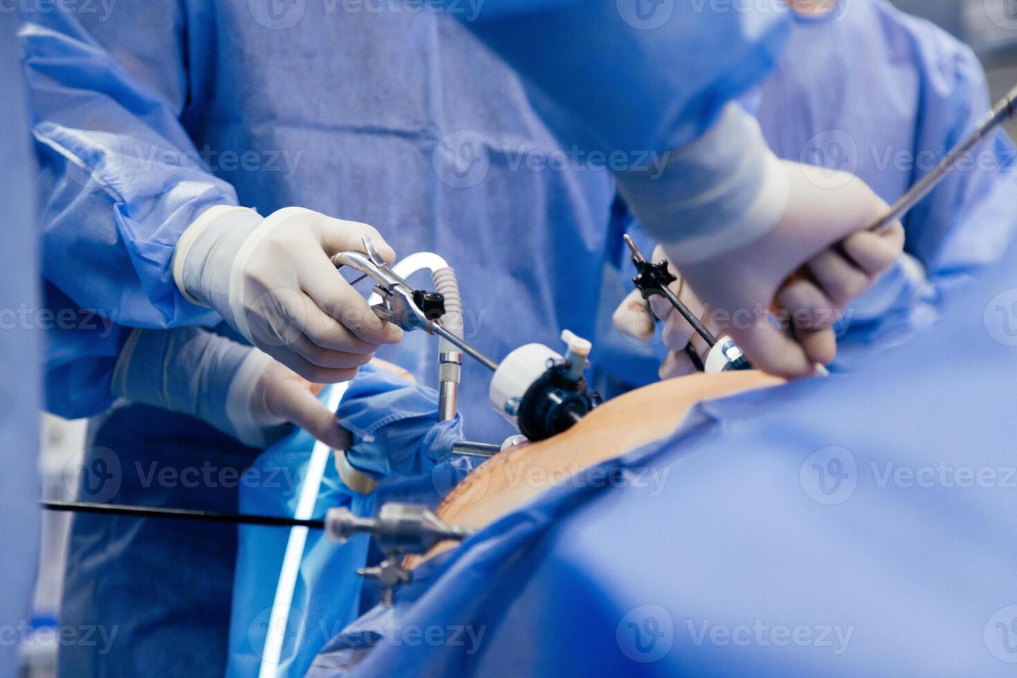 Instruments for gastroscopy and colonoscopy close-up. The doctor holds a flexible endoscope and biopsy forceps in his hands. Endoscopy and minimally invasive surgery photo