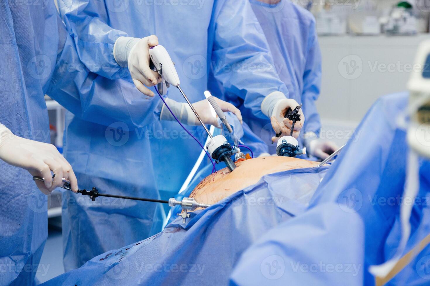 Doctor in blue sterile surgical gown doing surgery with camera and instrument. Keyhole surgery was perform in modern operating room. Advanced laparoscopy photo