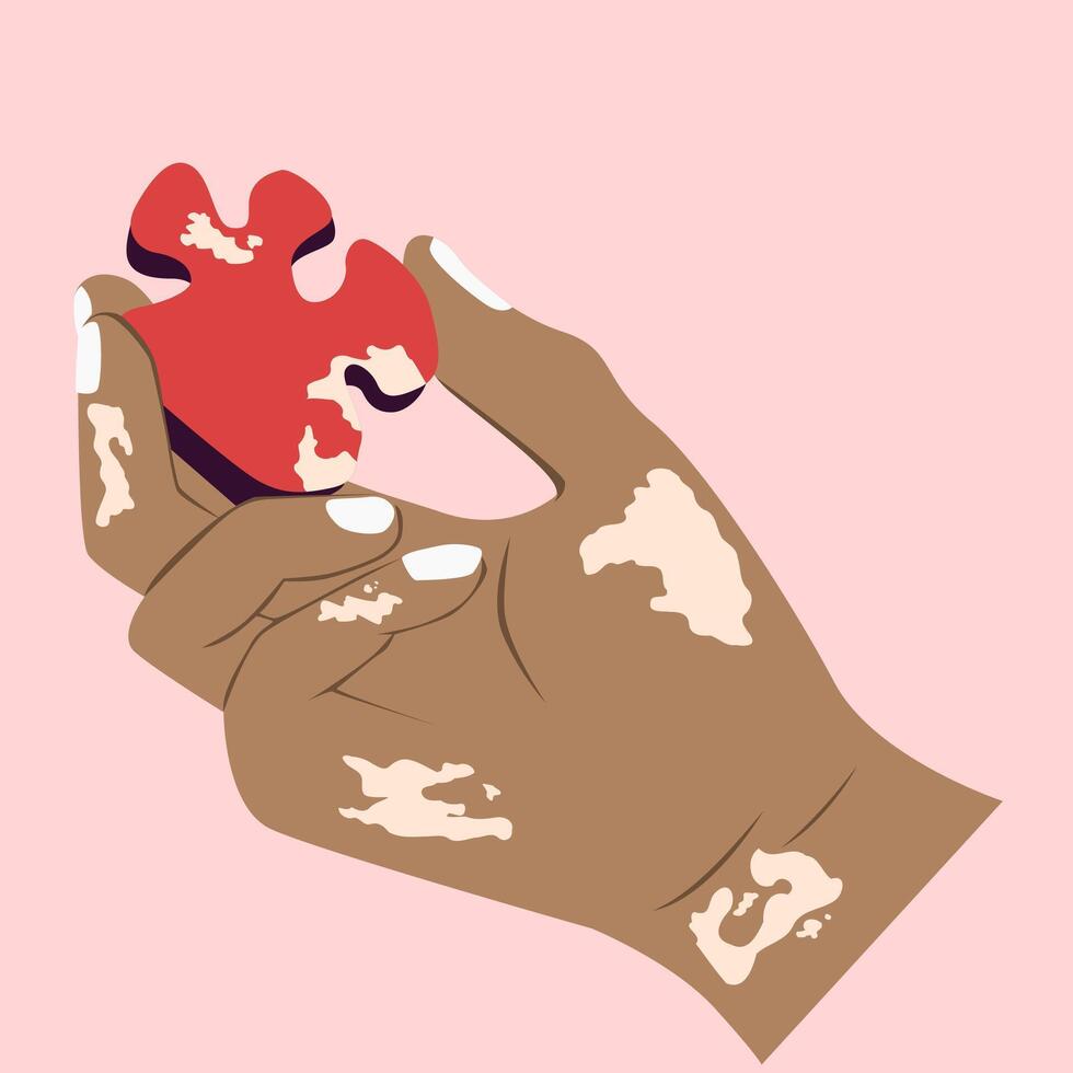 Illustration of a dark skin hand with vitiligo holding a vitiligo-patterned red puzzle vector