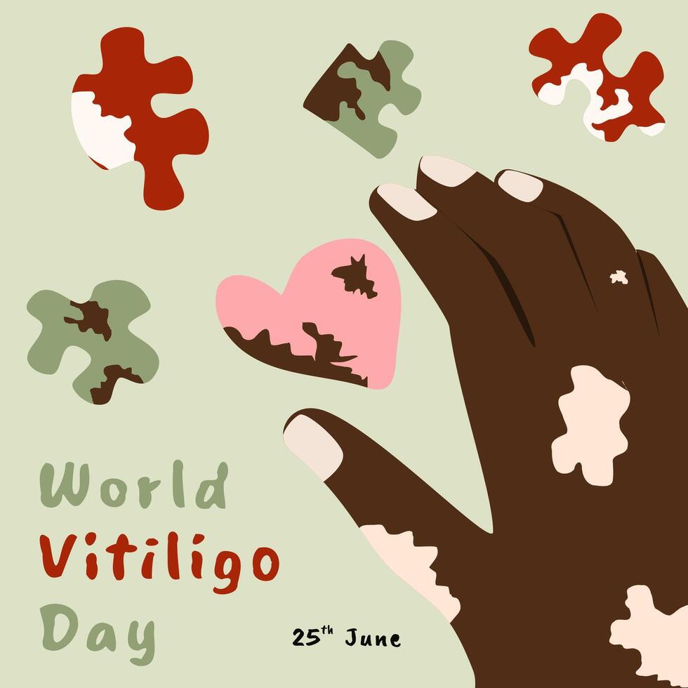 Illustration of World Vitiligo Day greeting with dark skin hand and puzzle pieces vector