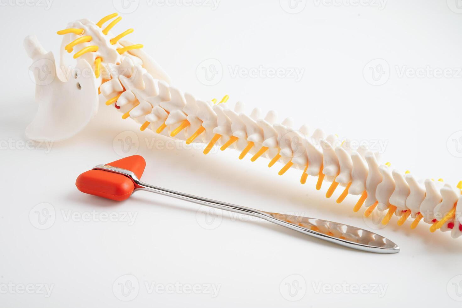 Spinal nerve and bone with knee reflex hammer, Lumbar spine displaced herniated disc fragment, Model for treatment medical in the orthopedic department. photo