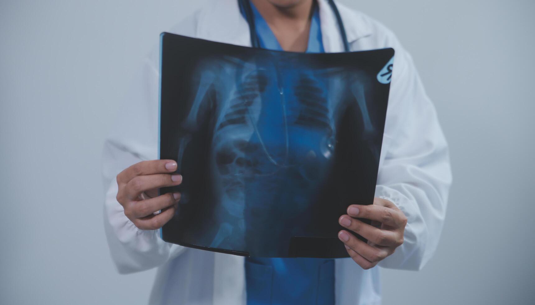 Asian Muslim doctor in hijab and scrubs headphones around her neck Stand confidently in the medical office, isolated on white background, holding x-ray film. photo