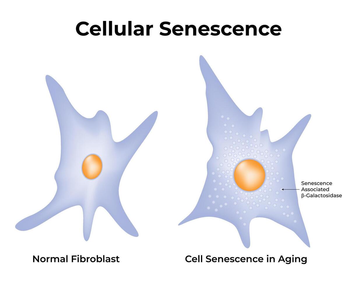 Cellular Senescence Science Design Illustration Diagram 44792870 Vector Biology Diagrams