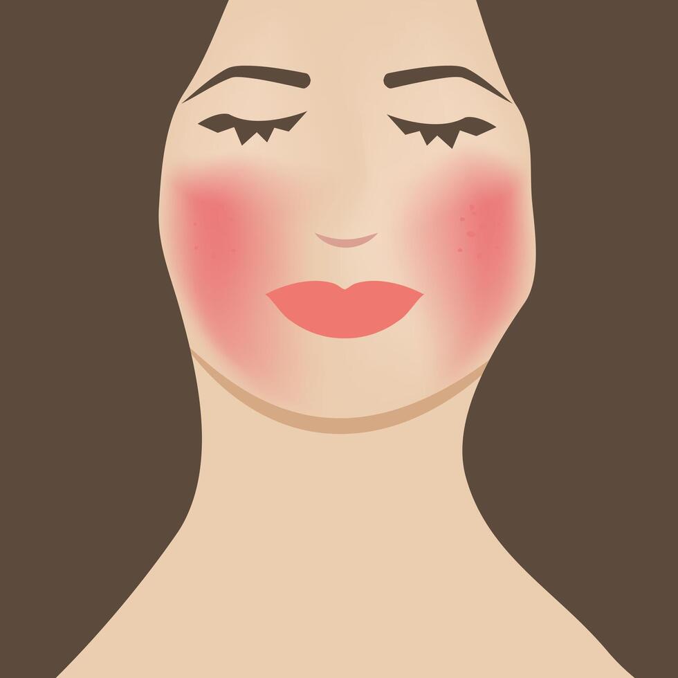 Woman Face Close Up with Rosacea Illustration Design vector