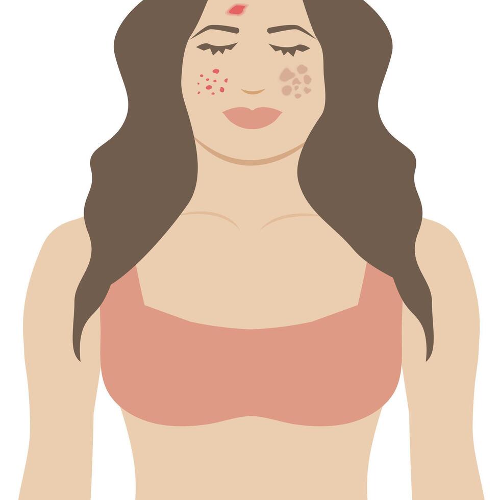 Isolated Girl with Skin Issues. Woman with Eczema, Acne and Melasma Skin Problems vector