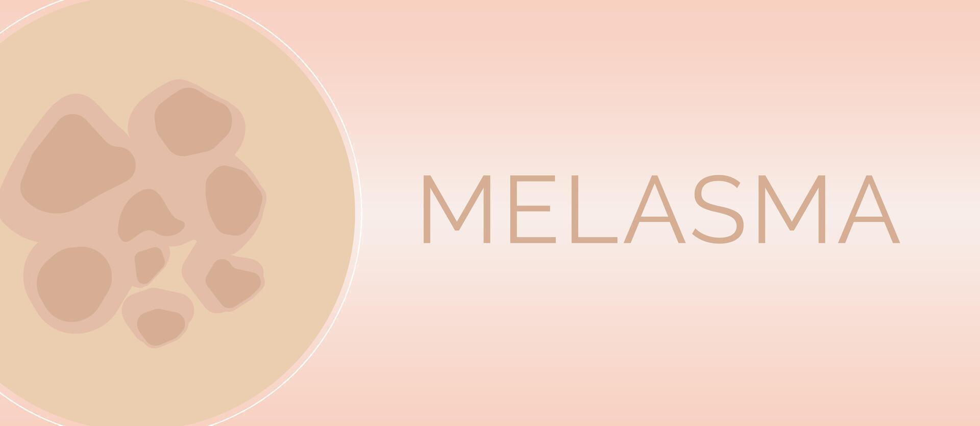 Melasma Skin Condition Illustration Design vector