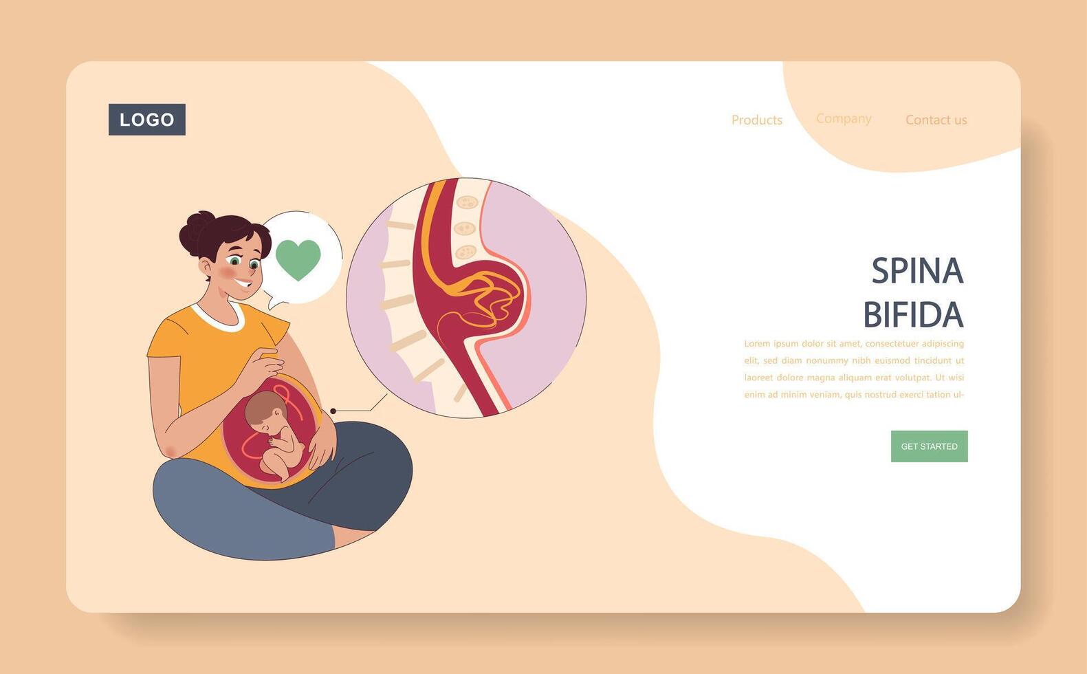 Spina Bifida concept. vector