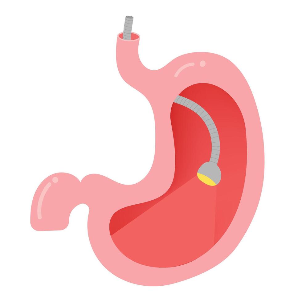 Human's Stomach, Stomach endoscopy. vector