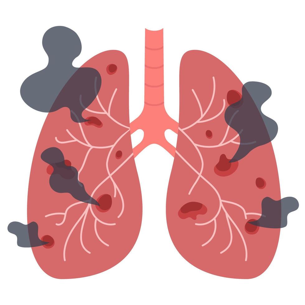Unhealthy lungs damaged by smoking vector