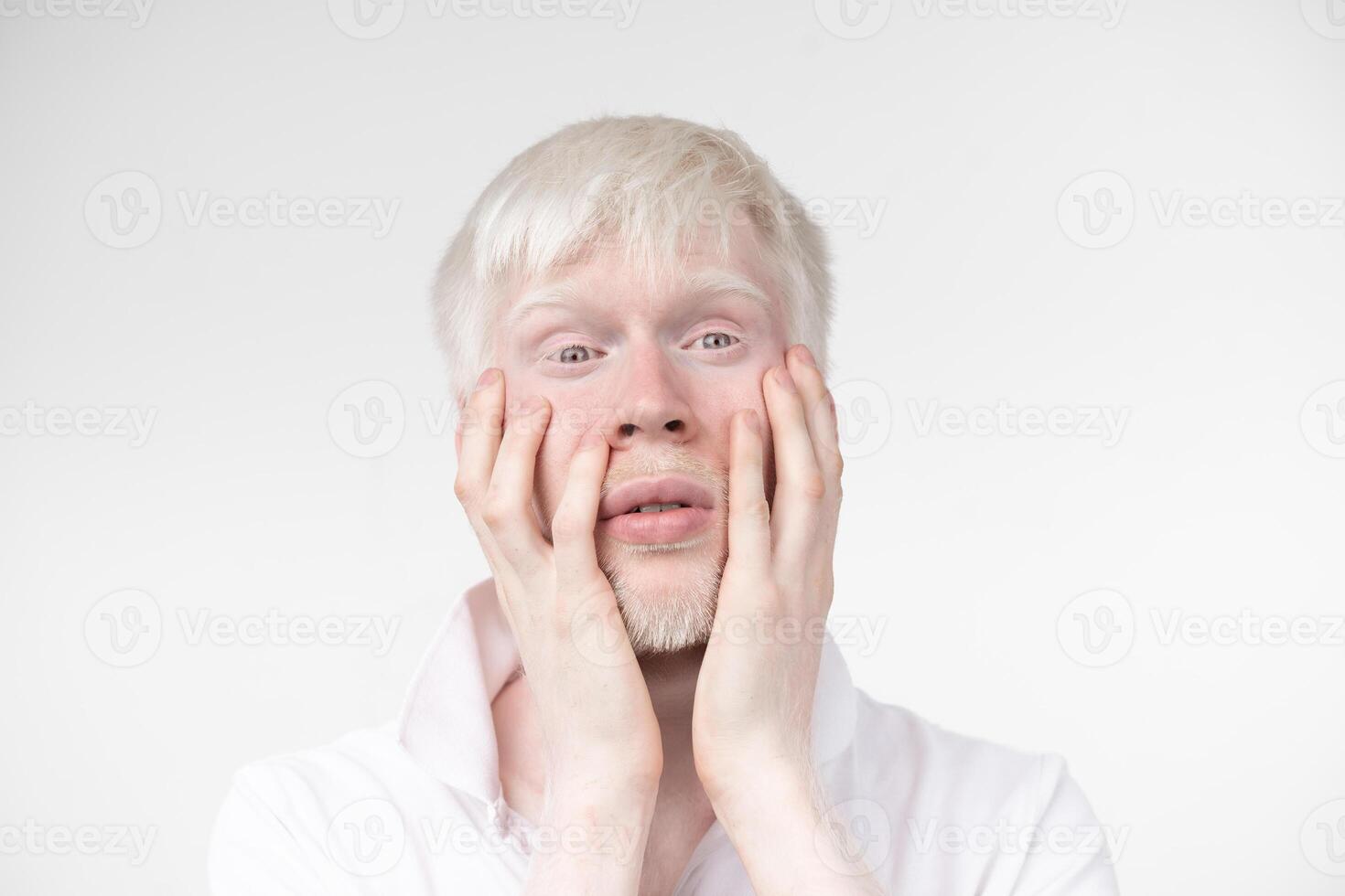 portrait of an albino man in  studio dressed t-shirt isolated on a white background. abnormal deviations. unusual appearance photo