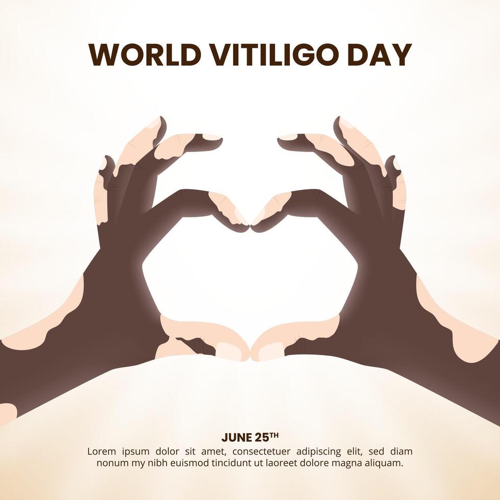 World Vitiligo Day background with love shaped hands vector