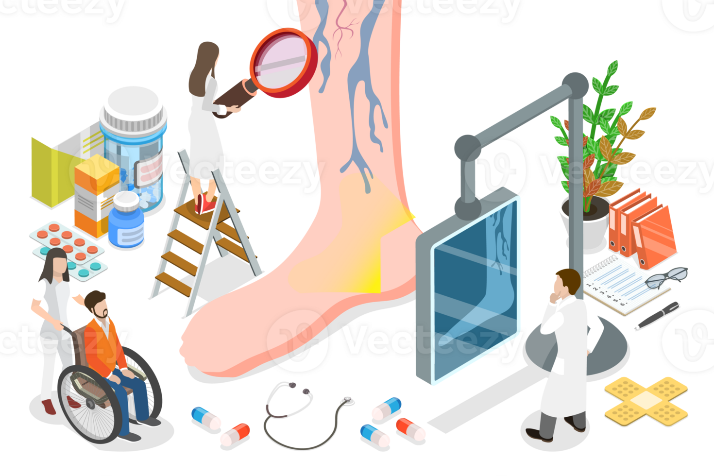 3D Isometric Flat Conceptual Illustration of Varicose Veins png