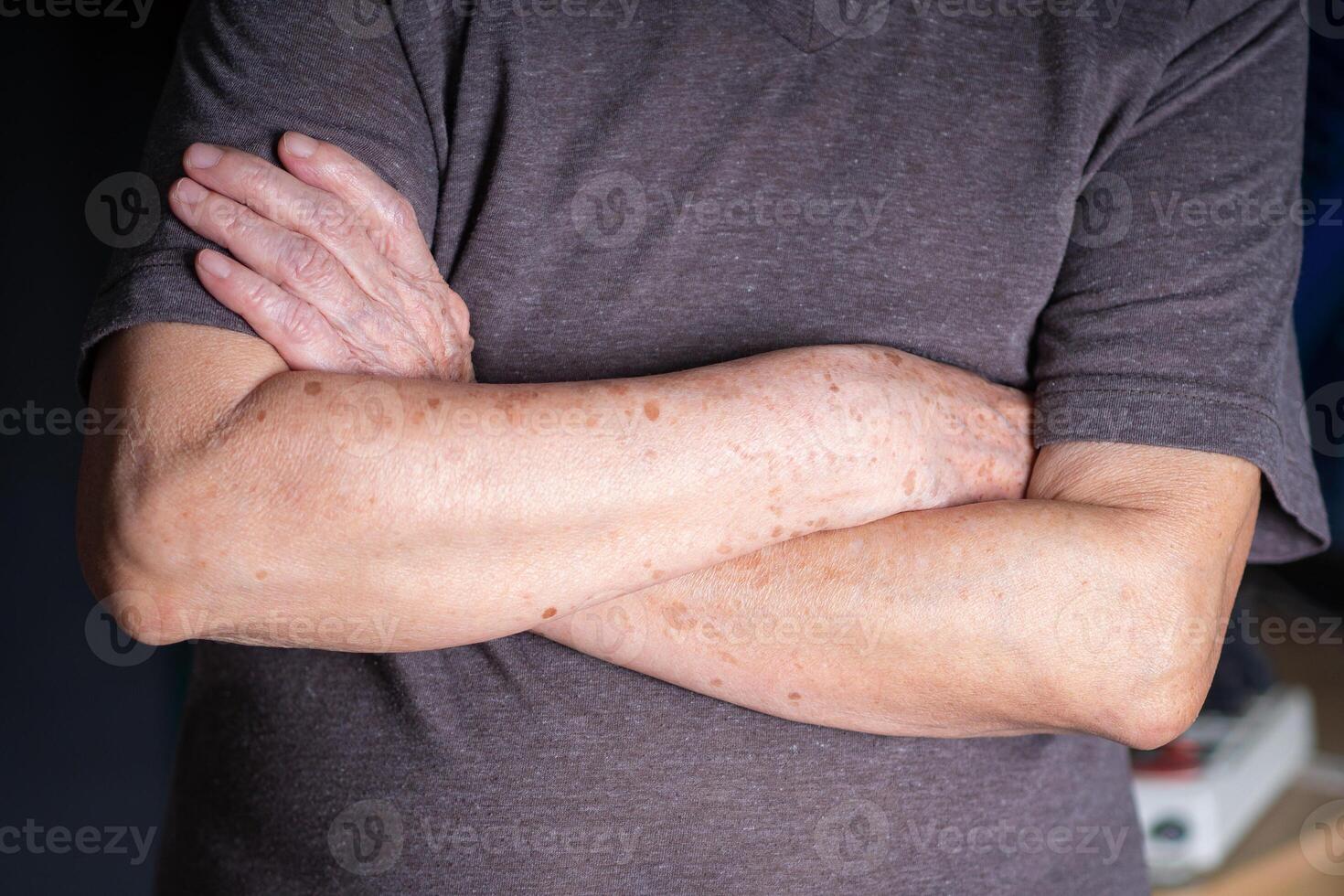Close-up of senior woman arms crossed while standing indoor. Concept of aged people and healthcare photo