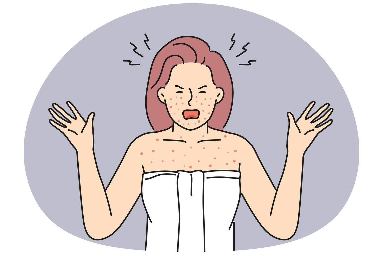 Angry woman distressed with allergy on body vector