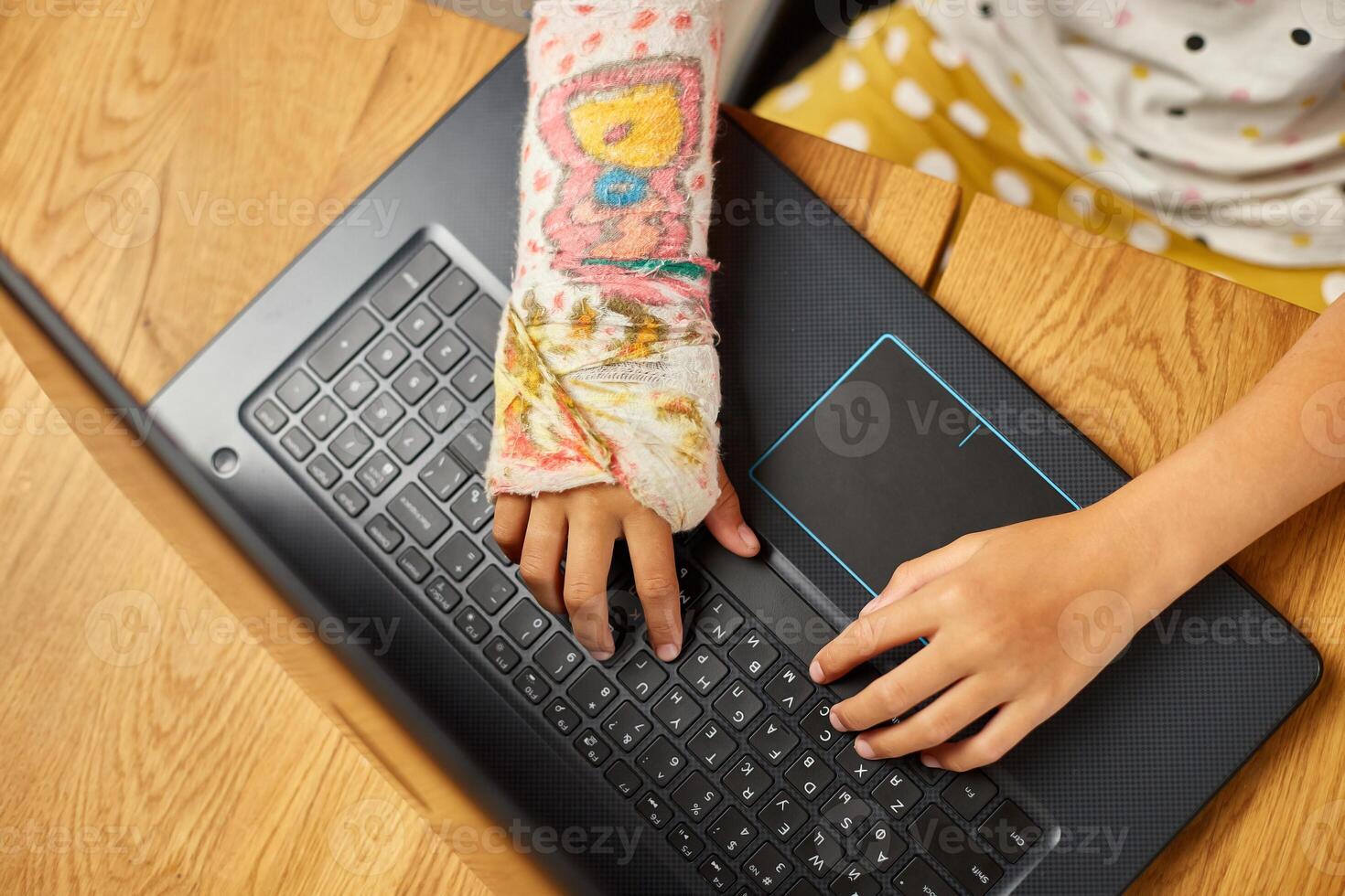 Teen girl with a broken arm orthopedic cast studying online photo