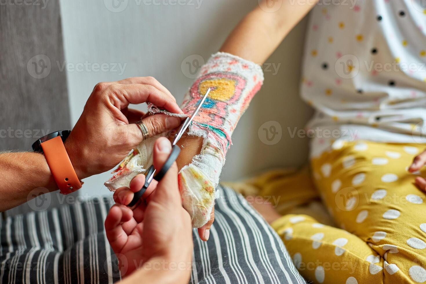 Father removing a plaster cast teen girl with a broken arm photo