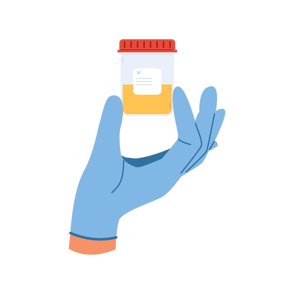 Plastic containers with pee sample. Urine analysis. Hand in gloves holds container with urine sample. vector