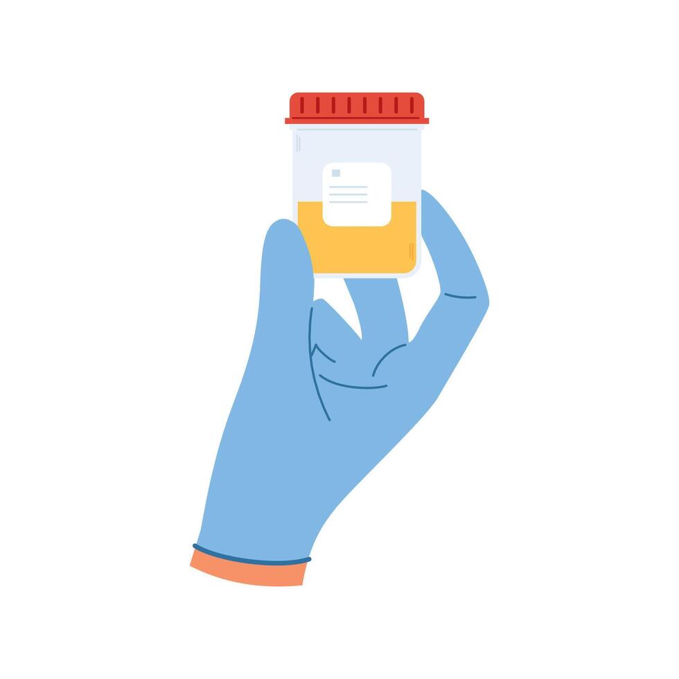 Urine analysis. Hand in gloves holds container with urine sample. Plastic containers with biomaterial vector