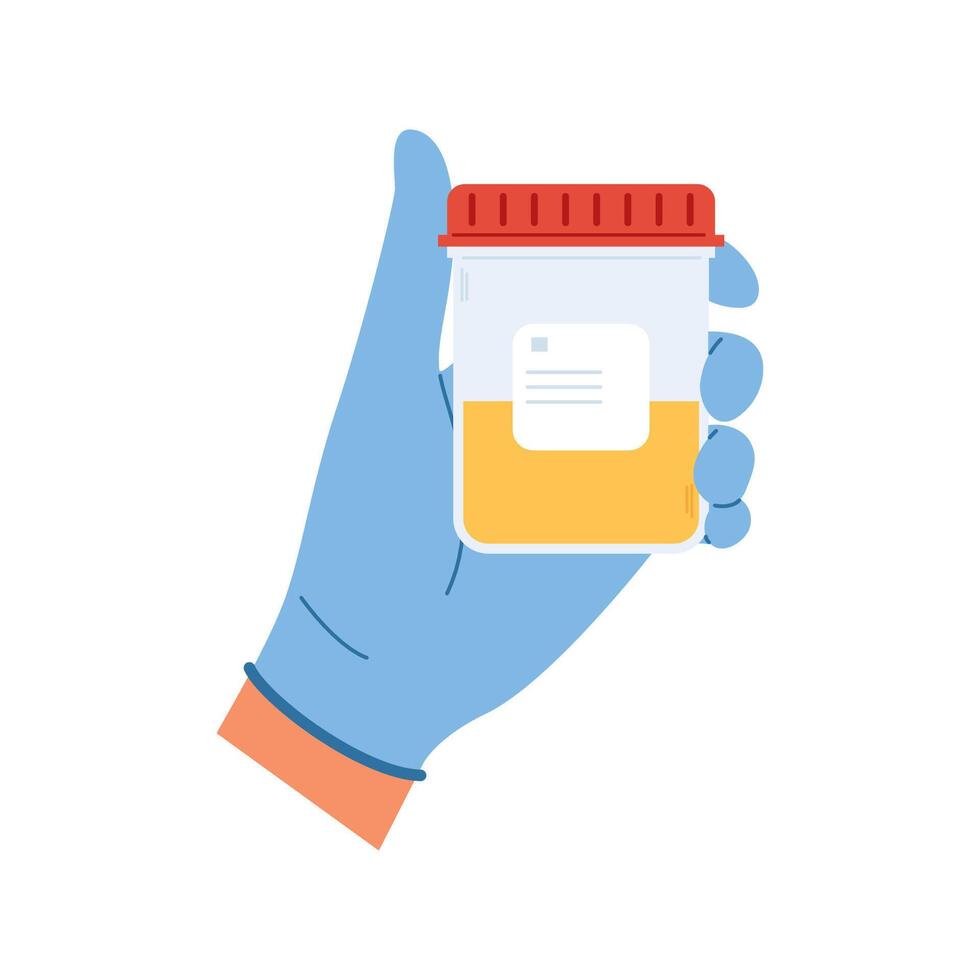 Medical sample in a plastic tube. Laboratory container with urine for diagnostic vector